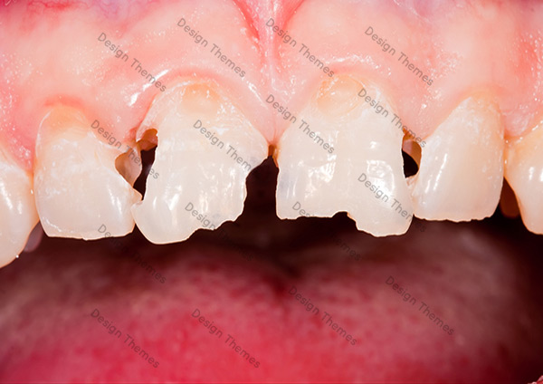 Before-Dental-3